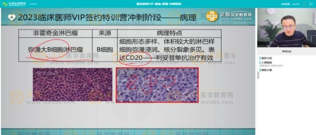 非霍奇金淋巴瘤考点回顾